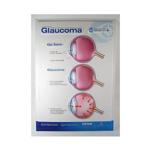 TERMOFORMADA GLAUCOMA - Artículos de Laboratorio Plasmare