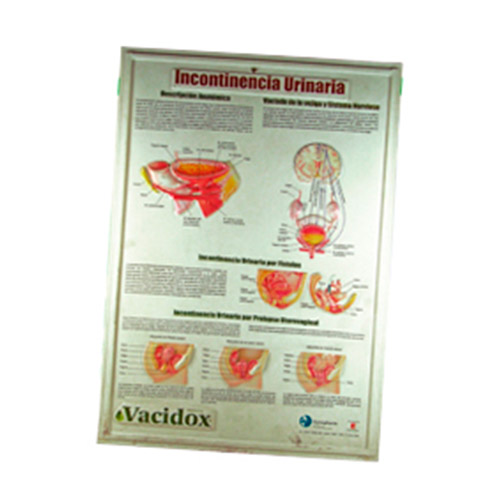 TERMOFORMADA INCONTINENCIA URINARIA - Artículos de Laboratorio Plasmare
